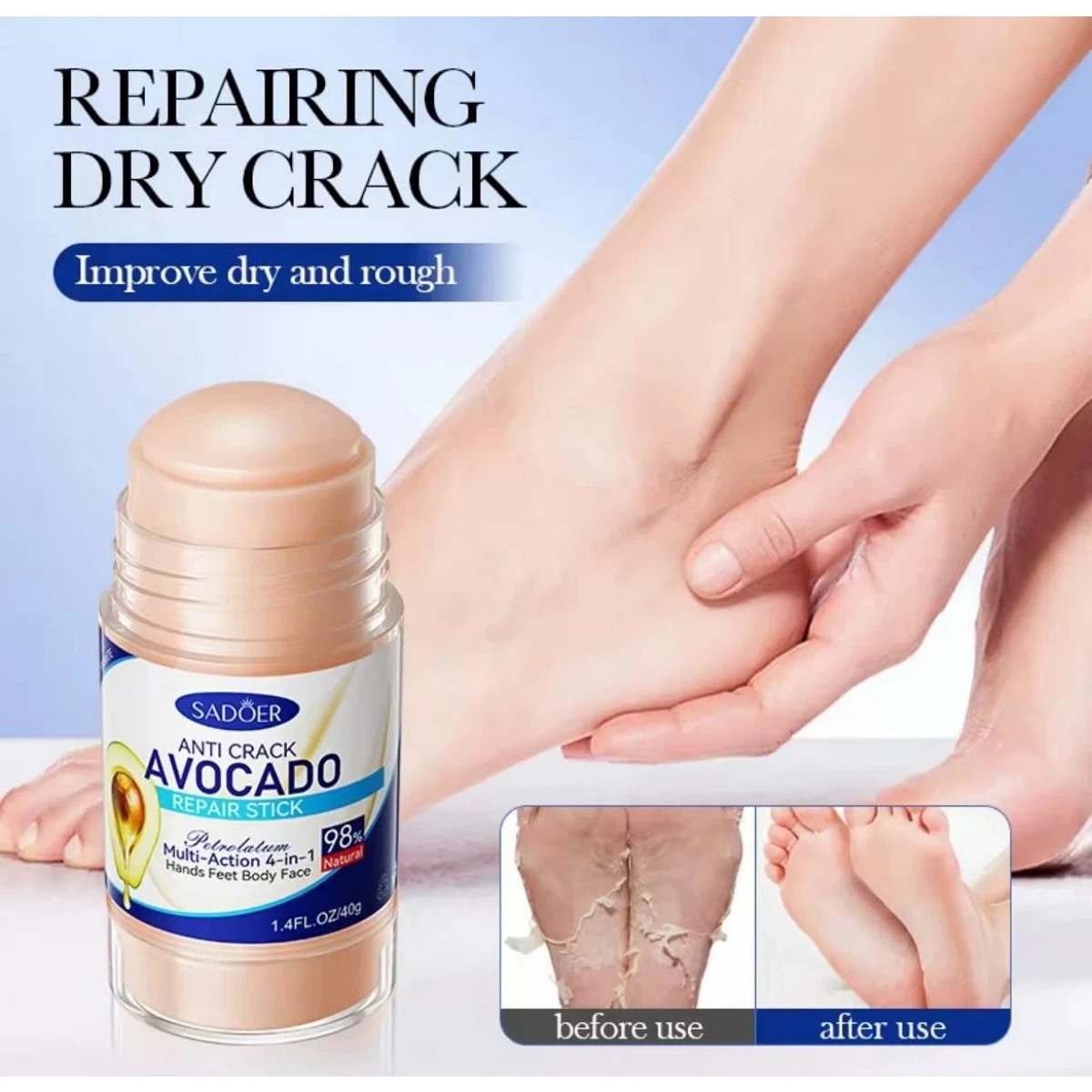 Anti Crack